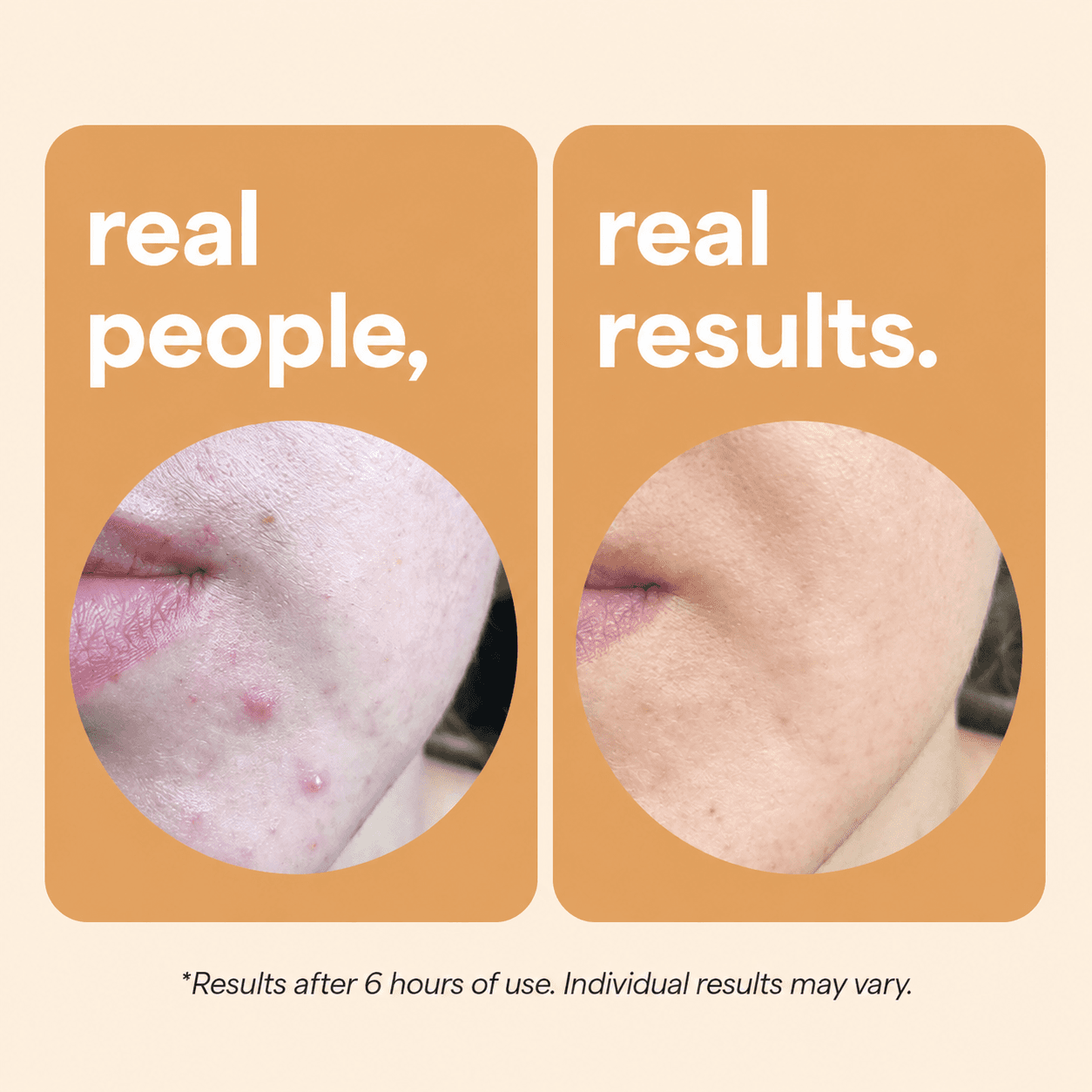 Skin Choice, Product images 3